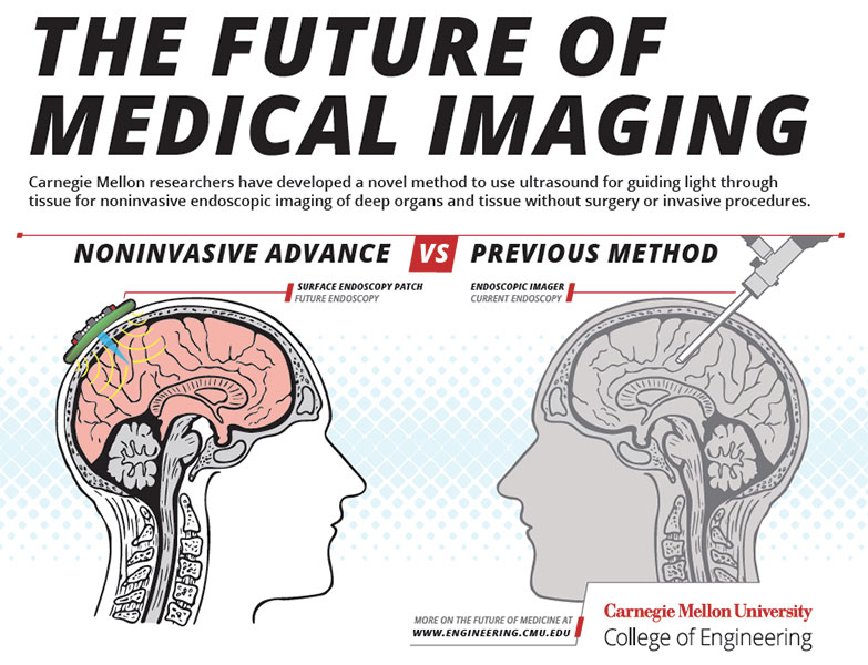 brain infographic