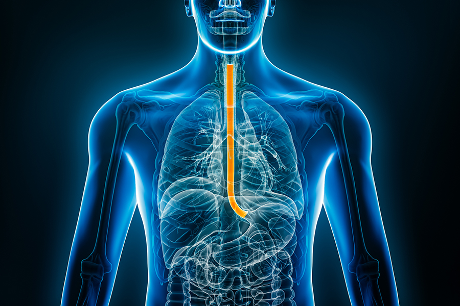 xray image of a person with the esophagus highlighted in yellow.